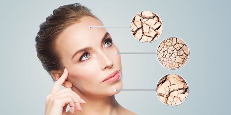 Dry skin illustration Dry skin illustration