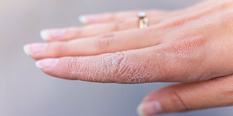 Dry hands Dry hands