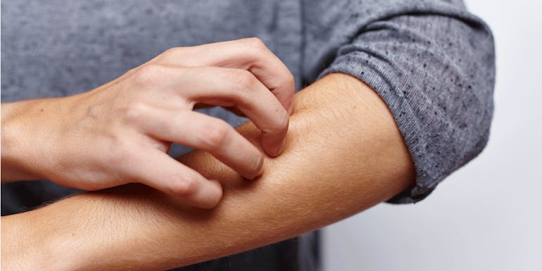 Man scratches his arm Man scratches his arm