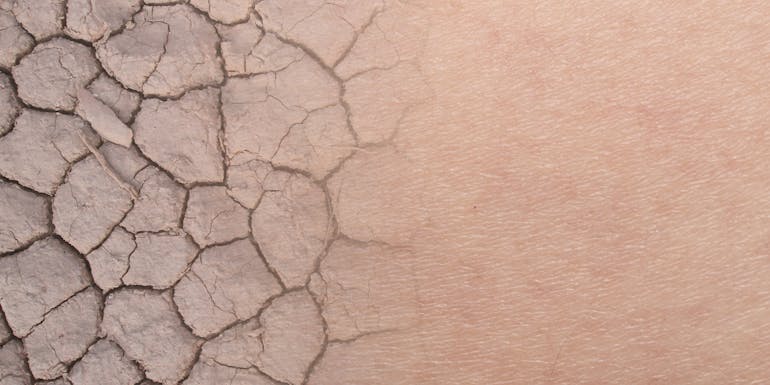 Symbolic image dry skin Symbolic image dry skin